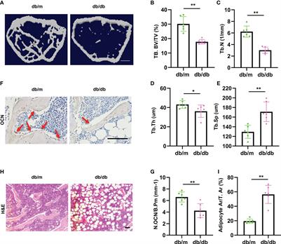 Bone marrow mesenchymal stem cells derived exosomal miRNAs can modulate diabetic bone-fat imbalance